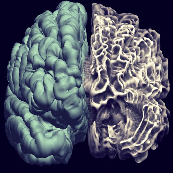 Brain Image - Left Inner and Right Pial