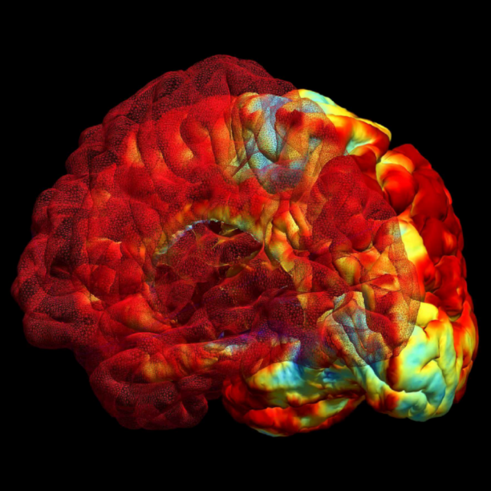 Image of brain