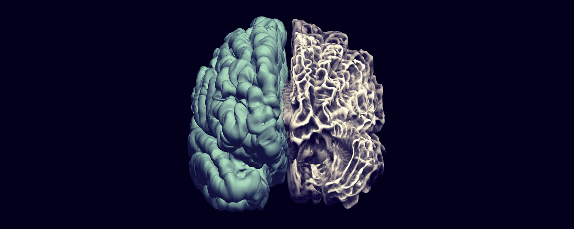 Beautiful Minds